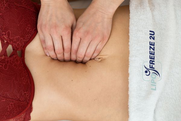 diastasis recti treatment Somerset