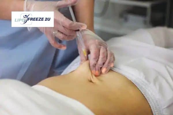 Fat Dissolving Injections Somerset & Weight loss medication