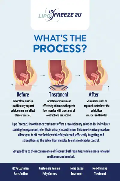 Diagram of how incontinence treatment Somerset works.