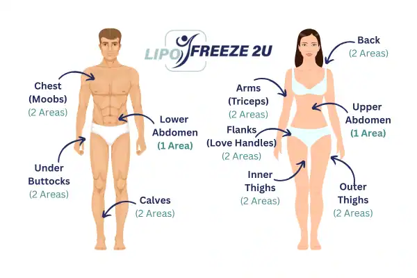 Areas you can have fat freezing treatment Somerset