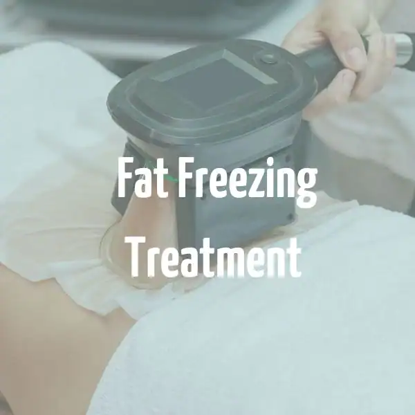 fat freezing treatment Somerset