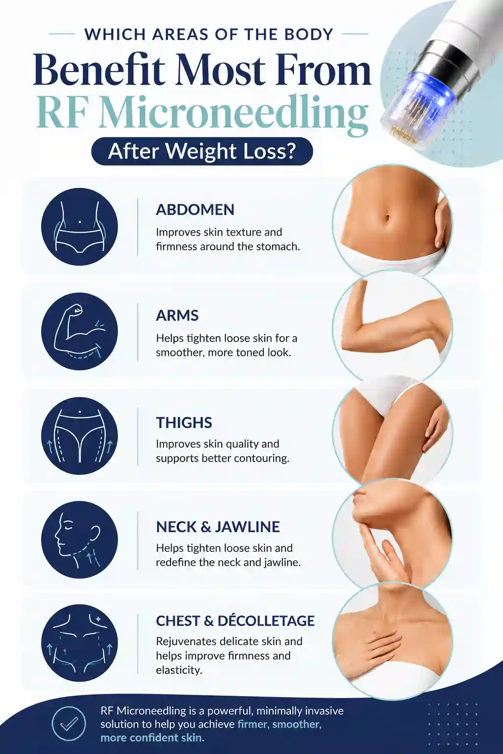 Which Areas of the Body Benefit Most From RF Microneedling After Weight Loss Somerset